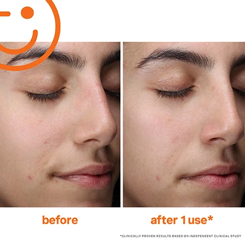 Image 1, before and after 1 use. clinically proven results based on independent clinical study. image 2, 91% reported visible improvement in skin's glow just 1 use. clinically proven results based on independent clinical study.