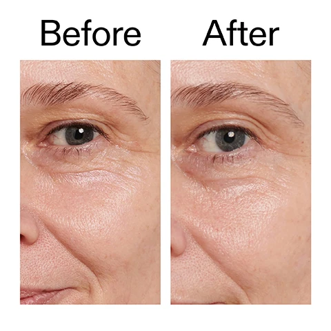 Image 1 - A split image of a persons face shows the eye and cheek area with more pronounced wrinkles on the left panel and smoother skin on the right panel, labeled Before and After. Image 2 - A close-up of a person with dark skin smiling with one hand near their nose and eye, accompanied by text that reads Why we love it, Brightens and reduces fine lines, Lightweight and fast-absorbing, Gentle formula for delicate eye area. Image 3 - A swatch of thick, off-white cream product is on a white background with text that reads Why it works, 3% Vitalease™ (Retinol), and TARGETS SIGNS OF AGEING WITH MINIMAL IRRITATION. Image 4 - A hand with a pea-sized amount of cream on the index fingertip is shown next to text detailing usage instructions: How to use USE A PEA-SIZED AMOUNT IN THE PM. MASSAGE ONTO UNDER-EYES. AFTER CLEANSER, BEFORE MOISTURISER. ALWAYS APPLY SPF IN THE AM. START 1-2 TIMES A WEEK, GRADUALLY BUILD UP TO DAILY USE. Image 5 - An off-white creamy texture with text that reads How to layer your routine and a list: 1 CLEANSE, 2 HYDRATE, 3 TREAT, 4 MOISTURISE, 5 SPF.