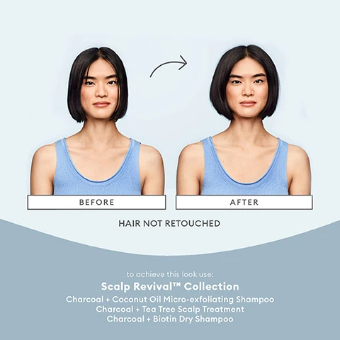 Image 1 - Image shows a woman with medium-length black hair styled in a bob, visibly different in two sections labeled BEFORE and AFTER; the left side depicts her hair before treatment, while the right side shows it after treatment, along with text that reads HAIR NOT RETOUCHED and a list of products including Scalp Revival™ Collection, Charcoal + Coconut Oil Micro-exfoliating Shampoo, Charcoal + Tea Tree Scalp Treatment, and Charcoal + Biotin Dry Shampoo.
Image 2 - Image shows a collage of natural ingredients with three subsections labeled binchotan charcoal, biotin, and witch hazel, each with a description of their benefits for hair health; visible text includes helps detoxify the hair and scalp by absorbing impurities and buildup, provides essential nutrients to the hair follicle that support healthy hair growth, and normalizes oil production to prevent oily scalp.
Image 3 - Image shows a collection of hair care products including a shampoo, styling cream, and a scalp mask, arranged with a coconut shell and charcoal pieces on a light blue background, with text that reads Scalp Revival collection clinically proven to increase scalp hydration.
Image 4 - A bottle of Briogeo Scalp Revival charcoal and biotin dry shampoo is shown, surrounded by mint leaves and charcoal pieces, with the text absorbs excess oil + detoxifies scalp.
