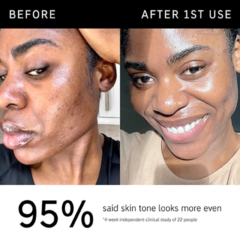 Image 1 - Image shows a side-by-side comparison of a persons face before and after using a skincare product, with the left side showing uneven skin tone and blemishes, and the right side showing smoother, glowing skin; visible text includes BEFORE, AFTER 1ST USE, 95% said skin tone looks more even, and *4-week independent clinical study of 22 people.
Image 2 - A tube of the INKEY LIST Omega Water Cream with product information, including text stating it increases skin hydration without leaving a greasy feel, minimizes excess oil, and describes it as an innovative gel-cream that transforms into a fresh, water-like texture.
Image 3 - A close-up of a woman applying a skincare product to her cheek, with text on the side stating 95% said skin tone looks more even**, Clinically proven to increase skin hydration levels*, Clinically proven to help balance oil*.
Image 4 - Image of a white background featuring text that lists the ingredients: 5% Niacinamide – Helps visibly brighten skin, even skin tone and minimize excess oil; Ceramide Complex – Helps optimize hydration and support the skins barrier; 3% Betaine – Reinforces the skins barrier to help skin adapt to moisture loss.
Image 5 - A close-up image of a woman applying a cream to her face, with text on the left side that reads FAQ, IS OMEGA WATER CREAM GOOD FOR BLEMISH-PRONE SKIN? Yes, this lightweight moisturizer is oil and silicone free and formulated without pore-clogging ingredients. DOES THIS SIT WELL UNDER MAKEUP? Yes, 100% of consumers who tested it said it works well under makeup. *4-week independent consumer trial of 22 people.
Image 6 - An image of a white cream swirl on a light background, accompanied by the text: How to layer your routine 1 Clean 2 Hydrate 3 Treat 4 Moisturise 5 SPF.
Image 7 - A hand holding a tube of Omega Water Cream by The Inkey List, with text next to it stating When to apply followed by sun and moon icons indicating AM and PM usage.
Image 8 - Two tubes of The Inkey List Omega Water Cream in different sizes are displayed side by side, with the larger tube labeled 100ML (200 uses) and the smaller tube labeled 50ML (100 uses), alongside the text Available in 2 sizes.