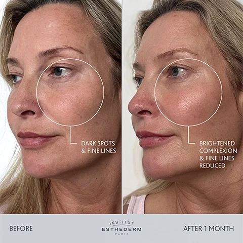 Image 1 - A before and after comparison image shows a womans profile, with the left side labeled BEFORE and an area around her eye and cheek highlighted with the text DARK SPOTS & FINE LINES, and the right side labeled AFTER 1 MONTH with the same area highlighted and the text BRIGHTENED COMPLEXION & FINE LINES REDUCED, with the logo INSTITUT ESTHEDERM PARIS at the bottom. Image 2 - A split image shows a womans face before and after one month of treatment; the left panel, labeled BEFORE, highlights DARK SPOTS & FINE LINES around her mouth, while the right panel, labeled AFTER 1 MONTH, shows a BRIGHTENED COMPLEXION & FINE LINES REDUCED in the same area, with INSTITUT ESTHEDERM PARIS displayed at the bottom. Image 3 - A before and after image shows a persons cheek with significant redness and texture BEFORE, visibly reduced redness and smoother skin AFTER 2 MONTHS of using INSTITUT ESTHEDERM PARIS AGE PROTEOM Advanced Serum, with accompanying text 66.67% NOTICED SIGNIFICANT CHANGES AFTER 3 MONTHS OF USE and 6 volunteers 30 to 55+ years old - 3 months of testing Age Proteom Advanced Serum. Image 4 - A white serum bottle labeled INSTITUT ESTHEDERM PARIS, AGE PROTEOM BIOTECHNOLOGIE BREVETEE, ADVANCED SERUM, Care first. NAOS, stands against a dark blue marbled background with white product droplets, next to statistics: 66.67% NOTICED SIGNIFICANT CHANGES AFTER 3 MONTHS OF USE, 67% WOULD RECOMMEND AGE PROTEOM TO A FRIEND OR FAMILY MEMBER, 60% SAY AFTER APPLYING AGE PROTEOM THE SKIN FEELS HYDRATED AND SOFT, 80% ARE ENJOYING HAVING AGE PROTEOM AS PART OF THEIR SKINCARE ROUTINE, with a small caption below reading: 6 volunteers 30 to 55+ years old – 3 months of testing Age Proteom Advanced Serum.