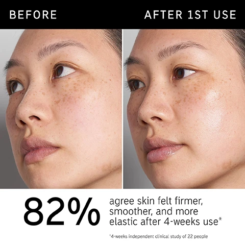 Image 1 - Image shows a side-by-side comparison of a persons face labeled Before on the left and After 1st Use on the right, with visible improvement in skin texture; text below states 82% agree skin felt firmer, smoother, and more elastic after 4-weeks use* *4-weeks independent clinical study of 22 people.
Image 2 - A white serum bottle labeled HYALURONIC ACID SERUM with a black cap and silver dropper, accompanied by text that reads Daily hydration essential for ALL skin types, Instantly hydrates and plumps, Fast-absorbing formula, non-sticky or tacky.
Image 3 - A close-up portrait of a woman with dewy skin, showcasing her natural beauty, accompanied by text stating that the product is clinically proven to deliver instant hydration, 82% of users experience hydration benefits, and 86% agree the serum is quick absorbing, lightweight, and non-tacky.
Image 4 - Image shows a white background with text listing ingredients: 2% multi-molecular hyaluronic acid delivers hydration across multiple layers of the skin and Matrixyl™ 3000 peptide visibly plumps, firms, and smooths.
Image 5 - A close-up of a womans face with a droplet of liquid on her cheek, accompanied by text that reads: FAQ HOW DO I KNOW IF I NEED HYALURONIC ACID SERUM IN MY ROUTINE? All skin types can experience dehydration. For this reason, keeping skin hydrated is an essential step for everybody, no matter your age, skin type, or skin concerns. DO I NEED TO USE MOISTURISER ON TOP? Yes, always. Applying a moisturizer after will help to seal all that hydration into the skin for longer-lasting results.
Image 6 - An abstract droplet of a clear, gel-like substance is shown against a light background, with the text How to layer your routine above it and numbered steps for a skincare routine: 1 Clean, 2 Hydrate, 3 Treat, 4 Moisturize, 5 SPF below.
Image 7 - A hand is shown applying a drop of serum from a small bottle, with visible text reading When to apply and icons representing AM and PM.
Image 8 - Close-up of a womans face displaying a droplet of liquid on her skin with text that reads Amount to apply and Pea sized amount.
