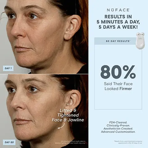 Image 1, DAY 1 DAY 60 Lifted & Tightened Face & Jawline Uvexohedo NUFACE RESULTS IN 5 MINUTES A DAY, 5 DAYS A WEEK! 60 DAY RESULTS 80% Said Their Face Looked Firmer FDA-Cleared. Clinically-Proven. Aesthetician Created. Advanced Customization. Image 2, + NUFACE 1 DEVICE 3 ATTACHMENTS CUSTOMIZED TREATMENTS 5 INTENSITY LEVELS MICROCURRENT TECHNOLOGY Perfect For: Customization NOFACE FACIAL TRAINER ATTACHMENT Tones, lifts and contours neck, cheek and forehead Additional told poly 5 SECOND BEEP AUTO SHUT OFF At 21 minutes CHARGING CRADLE FDA-Cleared. Clinically-Proven. Aesthetician Created. + Image 3, SMOOTH THE NECK CONTOUR THE CHEEKS 1 DEVICE, CUSTOMIZABLE RESULTS LIFT THE BROW NUFACE Image 4, NUFACE RESULTS IN 5 MINUTES A DAY, 5 DAYS A WEEK! 60 DAY RESULTS DAY 1 Smoother Skin 80% Saw Smoother Skin DAY 60 Uretched clinical re FDA-Cleared. Clinically-Proven. Aesthetician Created. Advanced Customization. Image 5, NUFACE RESULTS IN 5 MINUTES A DAY, 5 DAYS A WEEK! 60 DAY RESULTS DAY 1 82% Said Their Face Looked More Toned 80% Said Their Face Looked Firmer 78% Saw Smoother Skin DAY 60 FDA-Cleared. Clinically-Proven. Aesthetician Created. Advanced Customization. Image 6, + NUFACE 1 DEVICE 3 ATTACHMENTS CUSTOMIZED TREATMENTS 5 INTENSITY LEVELS NOFACE MICROCURRENT TECHNOLOGY Perfect For: Customization EFFECTIVE LIP & EYE ATTACHMENT Lifts & tightens hard-to-reach areas around the mouth & eyes 5 SECOND BEEP AUTO SHUT OFF At 21 minutes CHARGING CRADLE FDA-Cleared. Clinically-Proven. Aesthetician Created. + Image 7, TIGHTEN SKIN AROUND THE EYES LIFT THE BROW TARGETED RESULTS NUFACE LIFT THE LIPS & SMILE LINES Image 8, + NUFACE 1 DEVICE 3 ATTACHMENTS CUSTOMIZED TREATMENTS LED RED LIGHT TECHNOLOGY Perfect For: Customization NOFACE WRINKLE REDUCER ATTACHMENT Helps reduce full-face wrinkles with a combination of red, amber & infrared lights 3 MINUTE BEEP AUTO SHUT OFF At 21 minutes CHARGING CRADLE FDA-Cleared. Clinically-Proven. Aesthetician Created. + Image 9, UNDER EYE ON FOREHEAD HELP REDUCE LINES AND WRINKLES AROUND THE MOUTH NUFACE AROUND THE EYES Image 10, NUFACE TRINITY Customized Lifting MINI FIX® On-The-Go Lifting Instant Finisher DEPTH OF TREATMENT To the Muscle To the Muscle Skin's Surface INTENSITY LEVELS ATTACHMENT OPTIONS Eye and Lip Attachment and LED Red Light Attachment Sold Separately Jowls and Jawline MICROCURRENT TREATMENT AREAS 5 ✓ 3 1 ✓ Neck ✓ ✓ Cheeks & Forehead ✓ Around Eyes & Brow ✓ Around Mouth & Lips ✓ Smile Lines