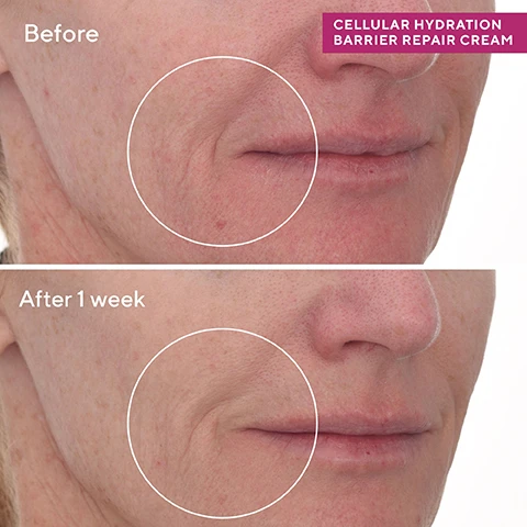 Image 1, before and after 1 week. image 2, immediately repairs dry, flaky skin, restores skin's bounce and radiance. nourishes and locks in barrier hydration for 24 hours at the cellular level. image 3, murad ingredients plus. fast acting compound = increases the tolerance of highly reactive skin. premium allantoin and oat like molecule = retains skin moisture while deeply soothing. handpicked bilberries = support a healthier barrier with omegas 3 and 6. image 4, your skin barrier repair regime. treats at a cellular level. 1 = soothing oat peptide cleanser - cleanse, rinse and pat dry. 2 = cellular hydration repair serum - apply an even later of serum onto clean skin. 3 = cellular hydration repair cream - massage cream evenly over face, neck and chest. apply SPF in the morning. 4 = celluar hydration repair mask - on nights your skin needs extra hydration, massage mask over face and neck, do not rinse until the morning.