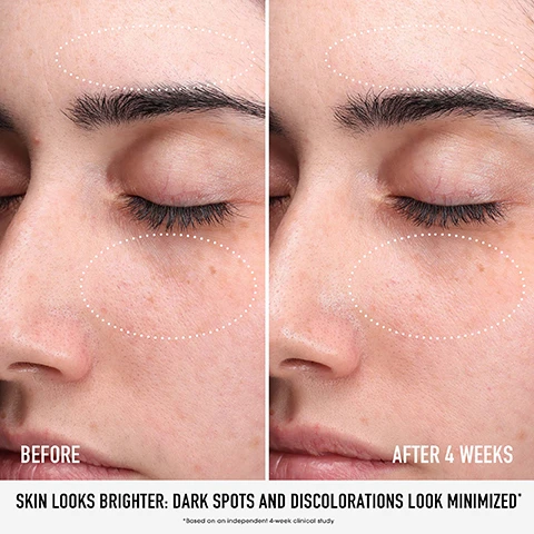 Image 1, before and after 4 weeks. skin looks brighter: dark spots and discolorations look minimised. based on an independent 4 week clinical study. image 2, routine to the rescue. start with clean, dry skin. step 1 = glow with skin rescue pure glow serum with 10% vitamin c complex and rainbow seaweed. AM step 2 = hydrate with skinlongevity phyto vitamin c  brightening moisturiser mineral SPF 30. PM step 2 = strengthen with skin longevity long life herb night treatment. step 3 = restore with skin longevity long life herb eye treatment. image 3, rescue your skin. step 1 = squeeze serum into your palm. step 2 = pat into clean, dry skin. step 3 = wait 5 minutes. step 4 = finish with moisturiser, adding SPF in the morning. image 4, dual patented sensitive base = backed by 10 years of research. chebula = helps treat sun damage and skin aging. 5% niacinamide = improves cell metabolism and skin texture. image 5, dual patented sensitive base = backed by 10 years of research. 10% vitamin c = helps stimulate collagen production and treat hyperpigmentation. rainbow seaweed = helps to smooth fine lines. image 6, visibly brightens skin instantly. reduces the appearance of dark spots and discoloration in 4 weeks. image 7, clinically proven. significantly improve the condition of skin in 1 week. based on an independent clinical study. clinically proven. fights signs of aging in 7 days. instantly reduces fine lines and wrinkles by 41%. based on an independent clinical study. image 8, how to recycle. 1 = remove post consumer recycled plastic cap from bottle. 2 = remove glass dropper from cap, rinse and recycle. 3 = rinse glass and bottle and recycle.