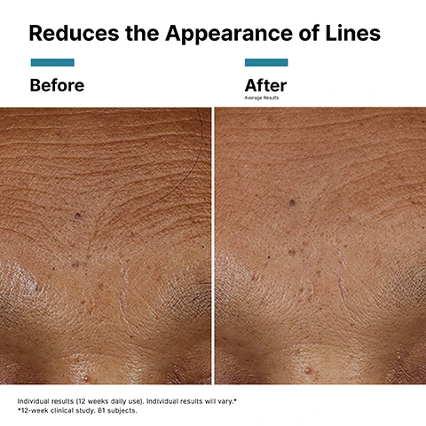 Image 1 - Image showing a side-by-side comparison of skin labeled Before on the left and After on the right, highlighting the reduced appearance of lines; visible text includes Reduces the Appearance of Lines and notes on individual results from a clinical study.
Image 2 - Image shows a glass petri dish with pink droplets indicating different skincare ingredients, accompanied by a dropper and labeled text listing KEY INGREDIENTS, 1.3% Hyaluronic Acid, 12% Proxylane™, 2% Post-Biotic Ferment Extract, and 2.0% Licorice Root Extract (Dipotassium Glycyrrhizate).
Image 3 - Image shows a close-up of pink serum-gel blobs with the text AT A GLANCE followed by Texture: Lightweight, serum-gel texture and Skin Type: • Normal • Oily • Dry • Combination • Sensitive.
Image 4 - A dark purple bottle of SkinCeuticals HA Intensifier Multi-Glycan serum is positioned next to a clear glass vial, with a dropper above the serum bottle; visible text includes INTEGRATED SKINCARE, Visibly Plumps + Contours Skin, Suitable for use in between injectable treatments, and HA Intensifier Multi-Glycan is a cosmetic treatment, always consult a Medical Professional.
Image 5 - A woman holds a dropper above her hand with a purple liquid, and the image includes text that states HOW TO APPLY, Step 1: Twice daily, after applying an antioxidant serum, dispense 4-6 drops into clean hands, and Step 2: Gently press evenly into skin. Follow with a moisturiser and sunscreen.
Image 6 - Image of a skincare routine guide featuring four products arranged from left to right, labeled as Step 1: Prevent with C E Ferulic, Step 2: Correct with HA Intensifier Multi-Glycan, Step 3: Correct with Triple Lipid Restore 2:4:2, and Step 4: Protect with Advanced Brightening UV Defense SPF 50, along with the heading COMPLETE THE MORNING ROUTINE.
Image 7 - Image showing a skincare nighttime routine with four product bottles labeled as step 1, step 2, step 3, and step 4, featuring Resveratrol B E, HA Intensifier Multi-Glycan, A.G.E Advanced Eye, and Triple Lipid Restore 2:4:2. Text at the top reads COMPLETE THE NIGHTTIME ROUTINE.