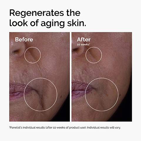 Image 1 - Image comparing the appearance of skin before and after treatment, showing prominent wrinkles and texture changes; visible text includes Regenerates the look of aging skin, Before, and After 10 weeks.
Image 2 - Image of a clear product with bubbles, accompanied by three icons and text stating Repairs Visible Skin Damage, Minimizes the Look of Fine Lines and Wrinkles, and Prevents the Look of Aging Skin.
Image 3 - Image showing a white background with bubbles and the text highlighting key ingredients in GF 15% Solution, listing three growth factors: TGF helps reduce lines and wrinkles, EGF promotes elasticity and firmness, IGF supports skin density and collagen production.